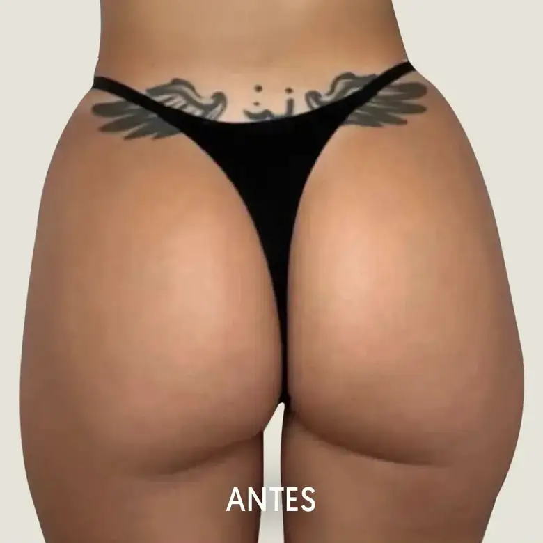 Antes de Antes y después de cintura de avispa