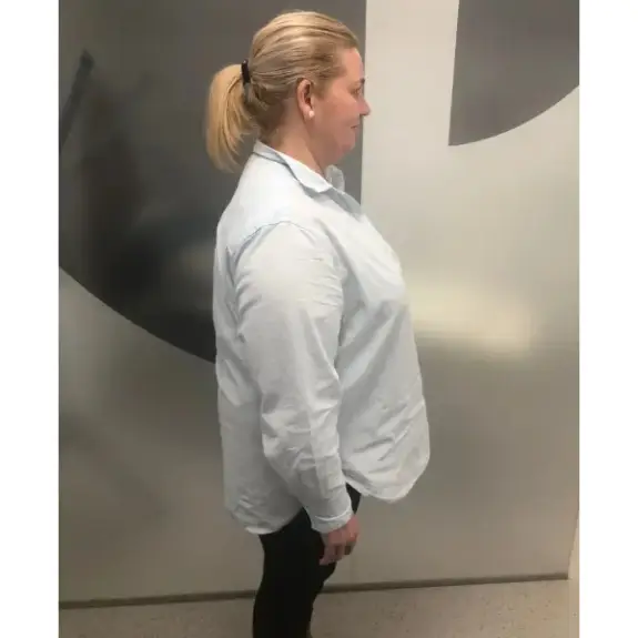 Antes de Perdió 28kg